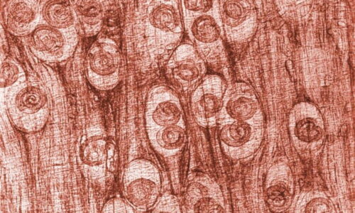 Triquinose: o que é, sintomas, ciclo de vida e tratamento