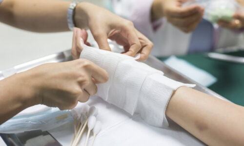 Primeiros socorros para queimadura química (e quando ir ao médico)