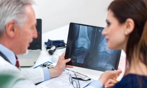 Artroplastia: o que é, quando é indicada, tipos (e recuperação)