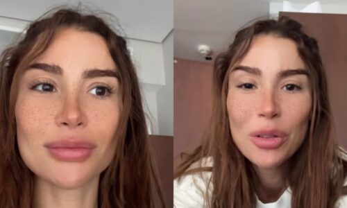 Bianca Andrade expõe perrengue e joelhos roxos nos ensaios do "Dança dos Famosos": "Desesperador"